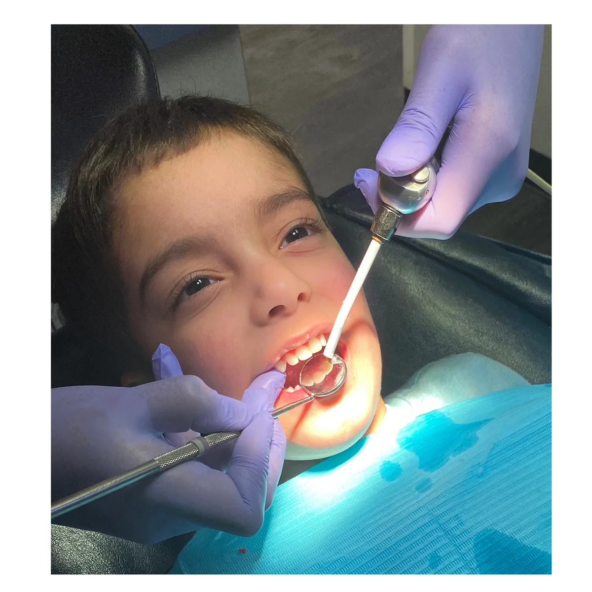 How to Handle Your Child's Dental Emergency in Fresno and Clovis with Sunnyside Smiles